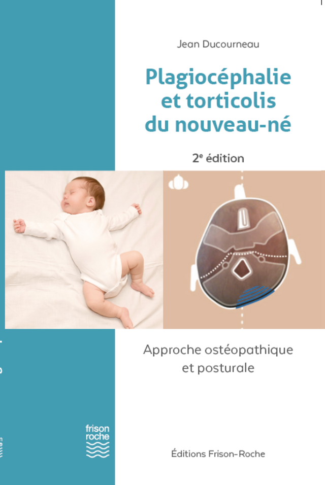 Plagiocéphalie et torticolis du nouveau-né, 2e édition - Ducourneau Jean - Editions Frison-Roche